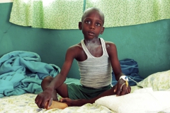 Haiti, Centre Sante, boy with typhus